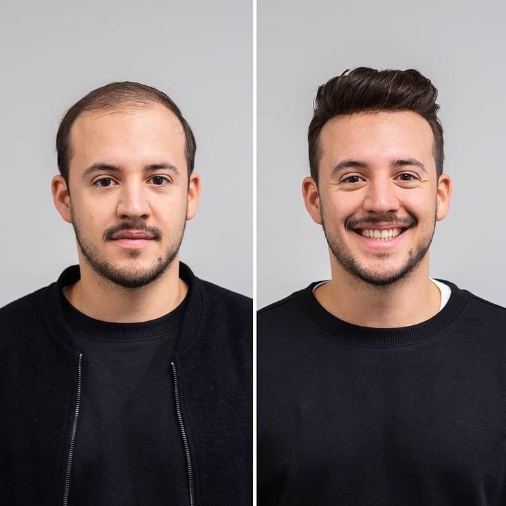 Hair Care Treatment